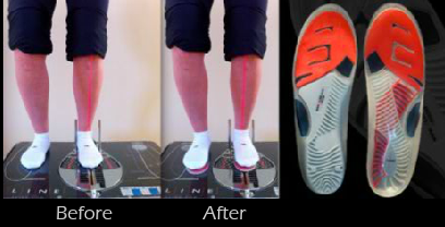 sports custom insoles manhattan ks chiropractor