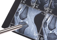 mri knee chiropractor manhattan ks